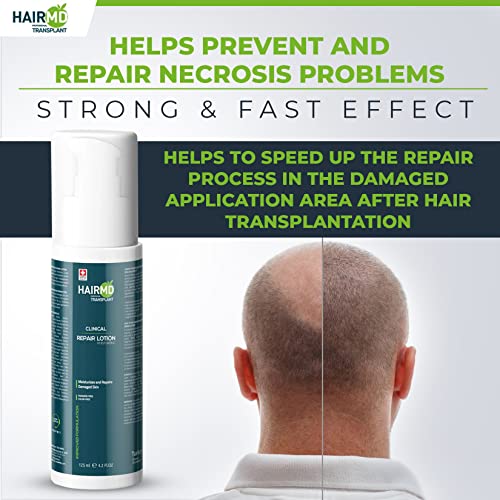 HairMD Transzplantációs Klinikai Repair Krém - 125ml Haj ellenére, hogy a Poszt-hajátültetés - Szelíd, Enyhe Formula - Tápláló,